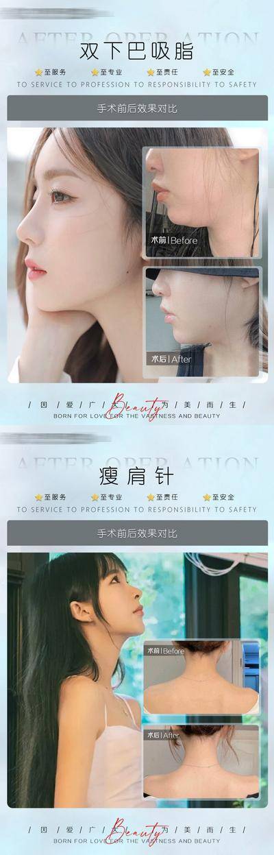 【南门网dcpsd.com】海报 医美 整形 美业 美容 案例 对比 简约 人物