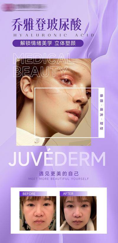 【南门网dcpsd.com】海报 医美 乔雅登 玻尿酸 模特 对比