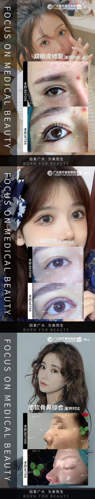 【南门网dcpsd.com】海报 医美 整形 真人案例 分享集 吸脂 对比图