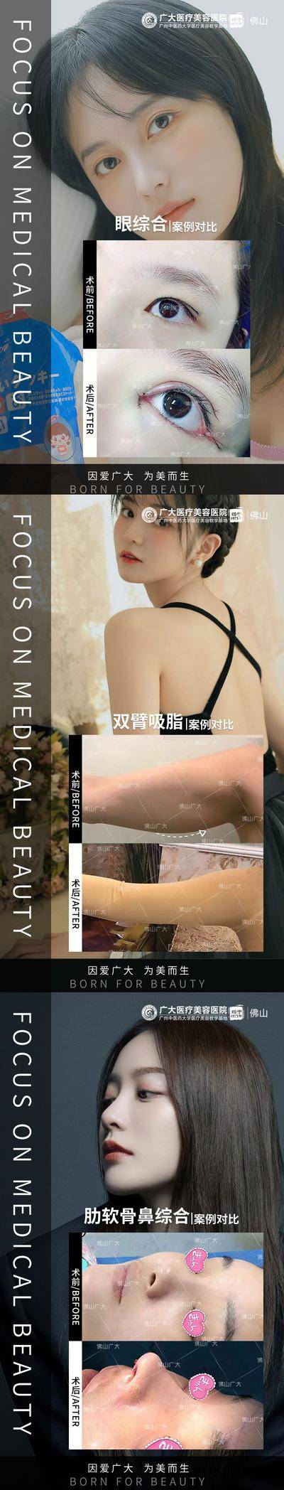 【南门网dcpsd.com】海报 医美 人物 对比 项目 案例 整形 鼻综合