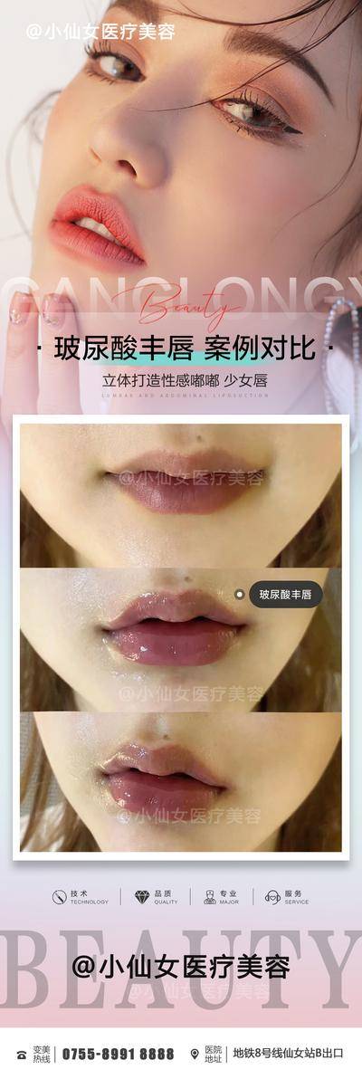 【南门网dcpsd.com】海报 长图 医美 整形 微整 玻尿酸 丰唇 案例 对比