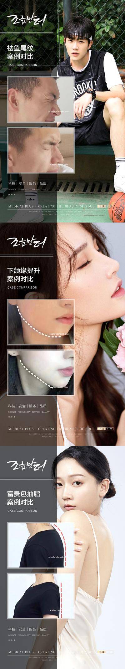 【南门网dcpsd.com】海报 医美 整形 美业 美容 案例 对比 祛鱼尾纹 除皱 下颌缘提升 富贵包 抽脂 系列
