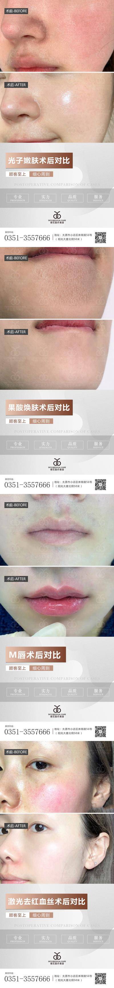 【南门网dcpsd.com】海报 医美 案例 对比图 简约