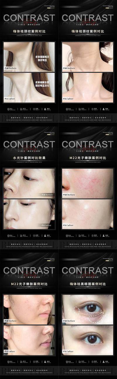 【南门网dcpsd.com】海报 医美 嗨体 颈纹 黑眼圈 光子嫩肤 水光针 案例 对比