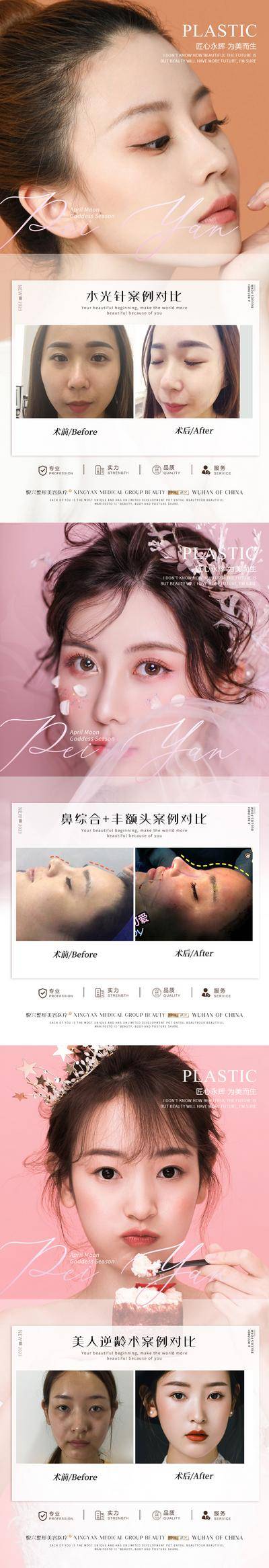 【南门网dcpsd.com】海报 医美 整形 案例 对比 简约 人物 水光针 眼综合 丰额头 逆龄