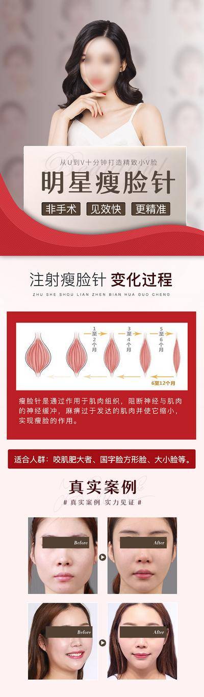 【南门网dcpsd.com】海报 长图 医美 整形 美容 瘦脸针 模特 案例 对比