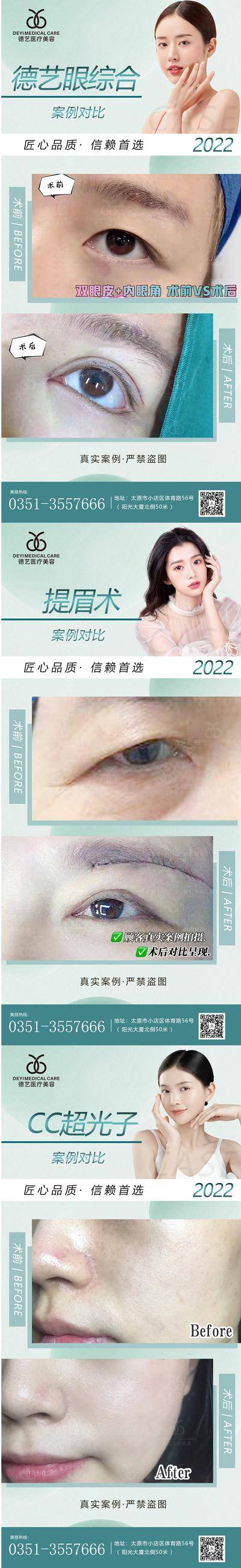 【南门网dcpsd.com】海报 医美 案例 对比 系列 人物