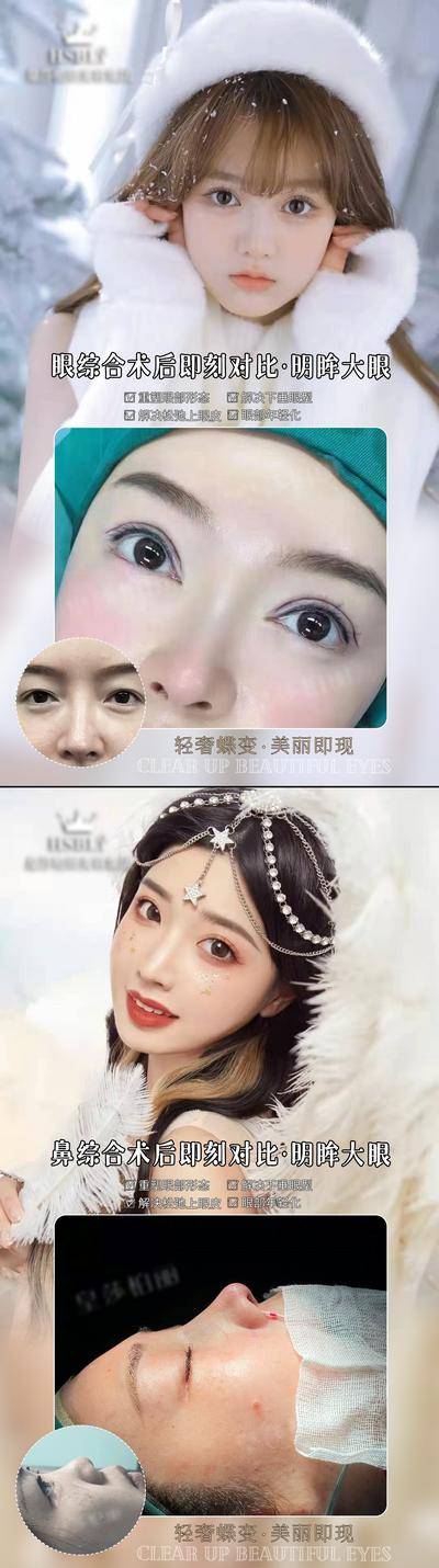 【南门网dcpsd.com】海报 医美 案例 眼综合 鼻综合 对比