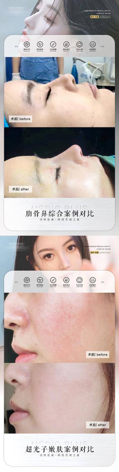 【南门网dcpsd.com】海报 医美 整形 案例 鼻子 隆鼻