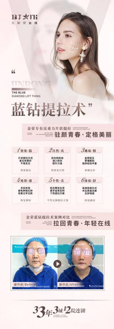【南门网dcpsd.com】海报 医美 线雕 提拉术 对比图 案例 青春 年轻