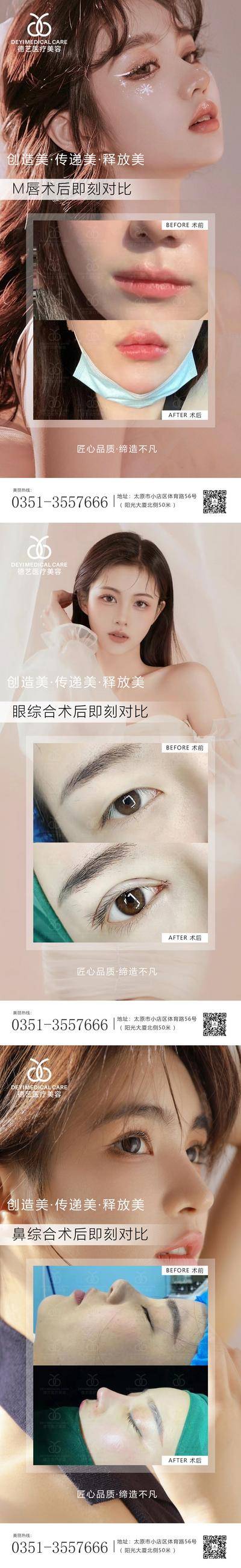【南门网dcpsd.com】海报 医美 整形 案例 对比图 M唇 眼综合 鼻综合 人物