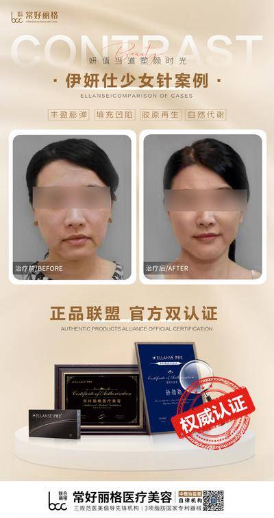 【南门网dcpsd.com】海报 医美 案例 对比 艾维岚 产品 伊妍仕