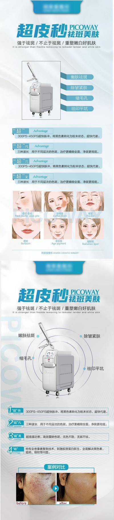 【南门网dcpsd.com】海报 长图 医美 整形 美容 超皮秒 仪器 对比