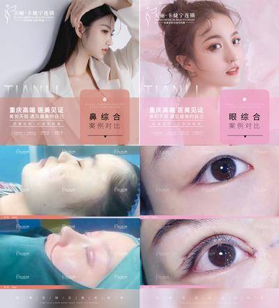 【南门网dcpsd.com】海报 医美 整形 案例 对比 人物 腰腹 吸脂 双眼皮 眼部 假体 下巴 系列