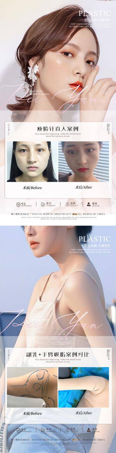 【南门网dcpsd.com】海报 医美 整形 案例 对比 简约 人物 瘦脸针 副乳 手臂吸脂