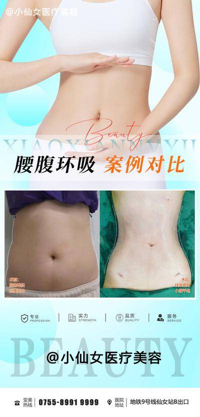 【南门网dcpsd.com】海报 医美 整形 腰腹 吸脂 案例 对比 塑美