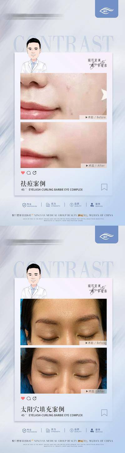 【南门网dcpsd.com】海报 医美 整形 美容 案例 对比 祛痘 太阳穴填充 系列
