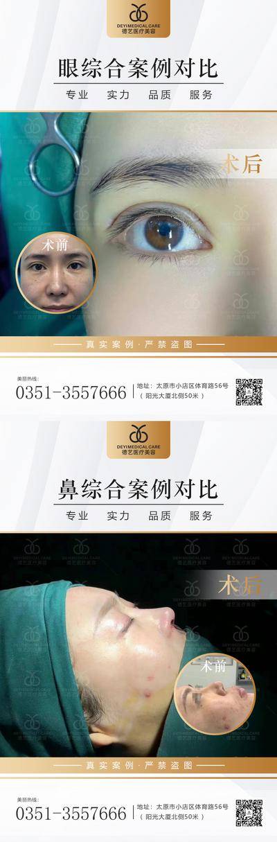 【南门网dcpsd.com】海报 医美 整形 眼综合 鼻综合 案例 对比图