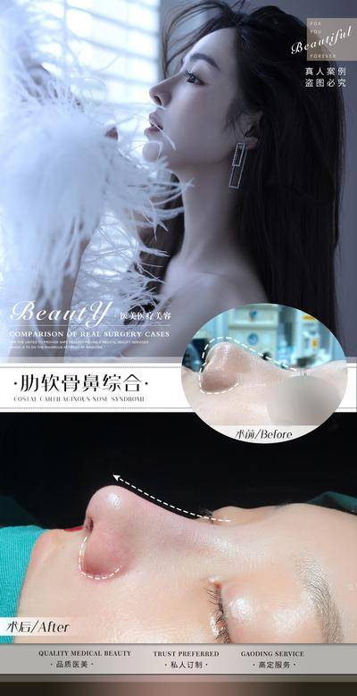 【南门网dcpsd.com】海报 医美 整形 案例 鼻综合 隆鼻 对比