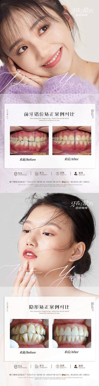 【南门网dcpsd.com】海报 医美 口腔 牙科 案例 对比 简约 人物 牙齿 前牙
