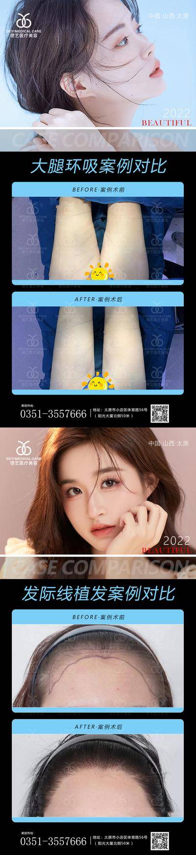 【南门网dcpsd.com】海报 医美 美容 吸脂 植发 发际线 案例