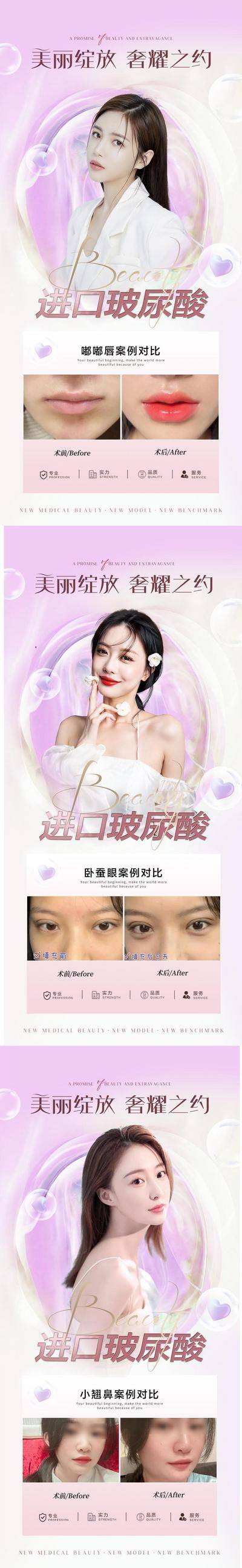 【南门网dcpsd.com】海报 医美 玻尿酸 隆鼻 丰唇 案例 对比 人物