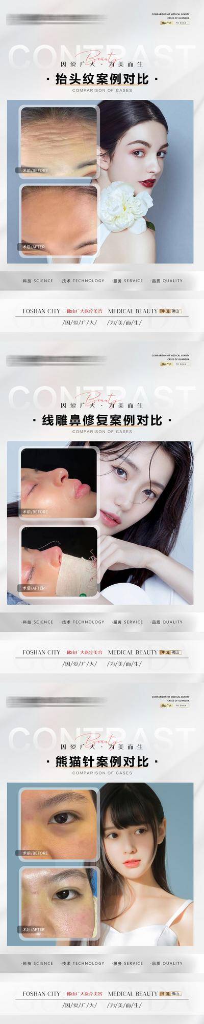 【南门网dcpsd.com】海报 医美 美容 案例 对比