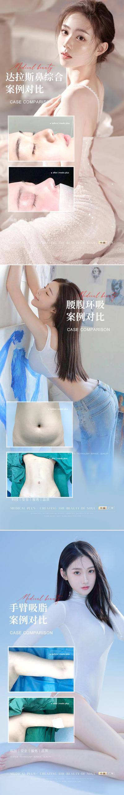 【南门网dcpsd.com】海报 医美 整形 案例 对比 简约 人物 隆鼻 腰腹环吸 手臂吸脂 系列