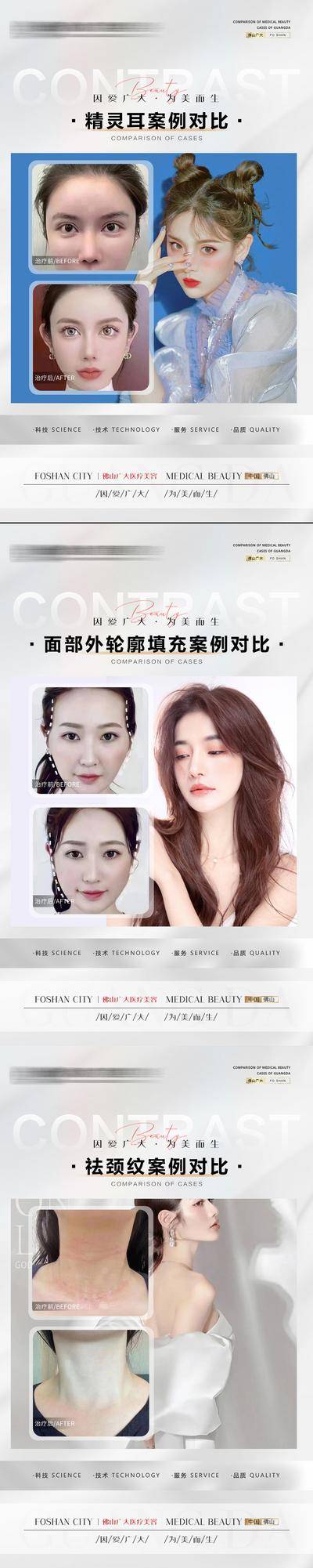 【南门网dcpsd.com】海报 医美 整形 案例 对比 人物 精灵耳 面部 轮廓 外轮廓 颈纹 系列