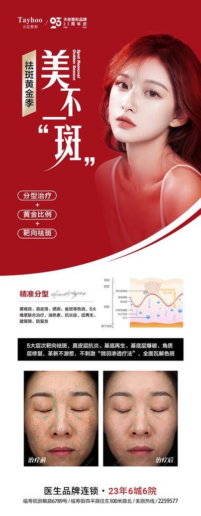 【南门网dcpsd.com】海报 医美 整形 祛斑 黄金季 案例 对比 美女 红色