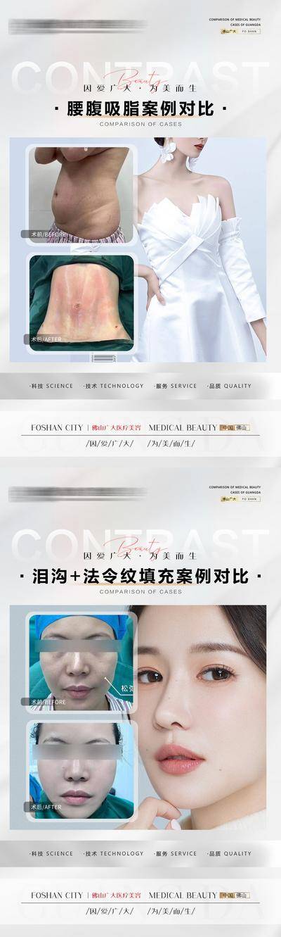 【南门网dcpsd.com】海报 医美 整形 案例 对比 腰腹吸脂 泪沟 法令纹填充 人物