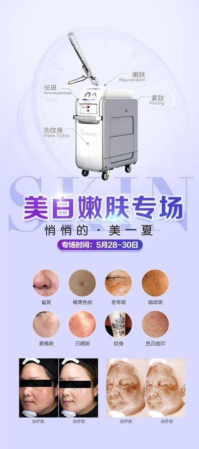 【南门网dcpsd.com】展架 易拉宝 医美 超皮秒 美白嫩肤专场 对比