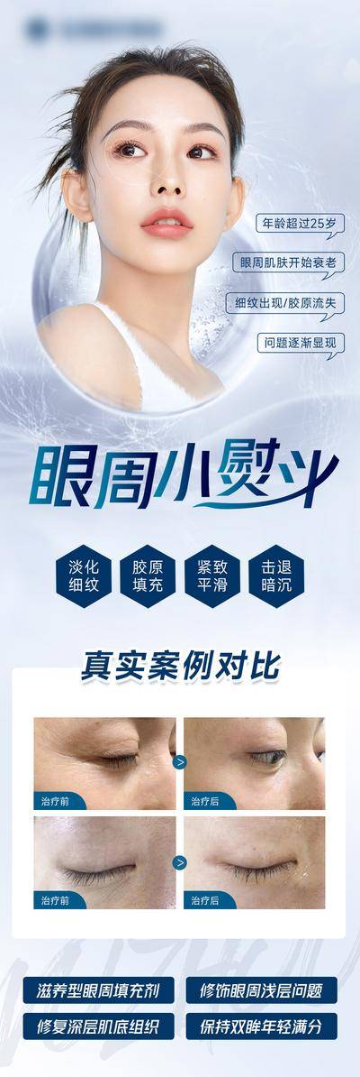 【南门网dcpsd.com】海报 长图 医美 整形 美容 眼周 小熨斗 案例 对比 人物