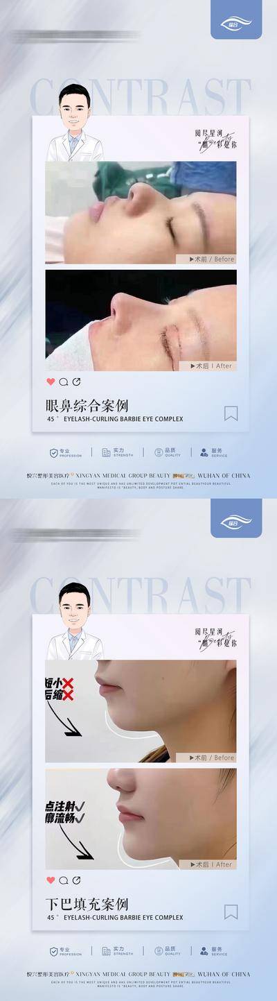 【南门网dcpsd.com】海报 医美 整形 案例 对比 人物 眼综合 下巴 填充