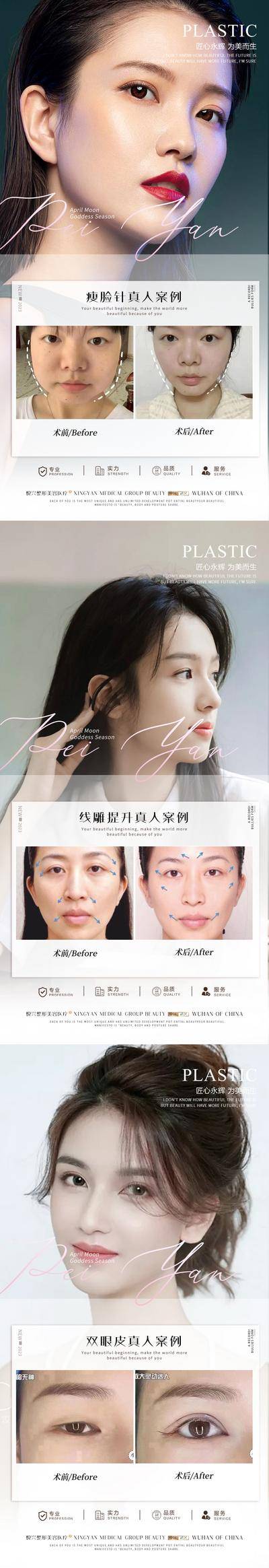 【南门网dcpsd.com】海报 医美 整形 案例 对比 双眼皮 瘦脸针 线雕 简约 系列