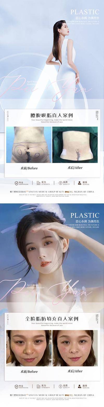【南门网dcpsd.com】海报 医美 整形 案例 对比 人物 腰腹 吸脂