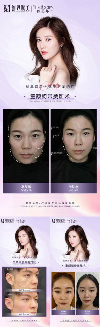 【南门网dcpsd.com】海报 医美 抗衰 案例分享 对比 模特 系列