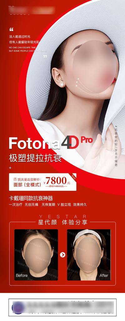 【南门网dcpsd.com】广告 海报 医美 人物 促销 仪器 Fotona4D 设备 案例 对比