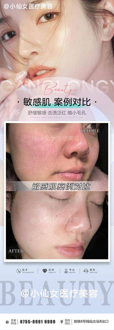 【南门网dcpsd.com】海报 长图 医美 美容 整形 敏感肌 案例 对比 简约