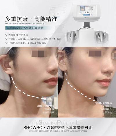 【南门网dcpsd.com】海报 医美 整形 案例 对比 7D 聚拉提