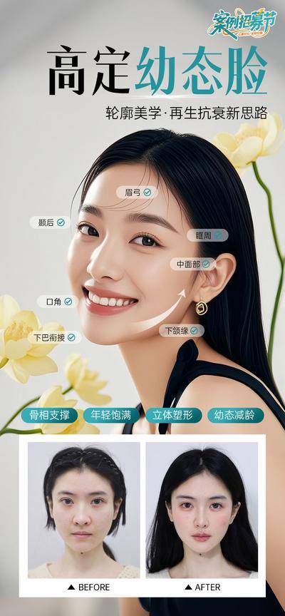 【南门网dcpsd.com】海报 医美 美容 案例 对比 招募 幼态脸 AI模特