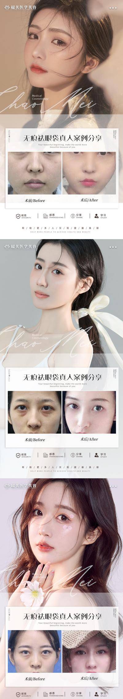 【南门网dcpsd.com】海报 医美 整形 美容 案例 对比 祛眼袋 系列