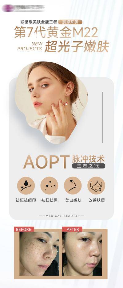 【南门网dcpsd.com】海报 医美 整形 嫩肤 M22超光子 案例 对比