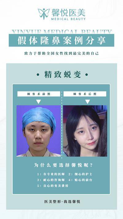 【南门网dcpsd.com】海报 医美 案例 整形 隆鼻 对比