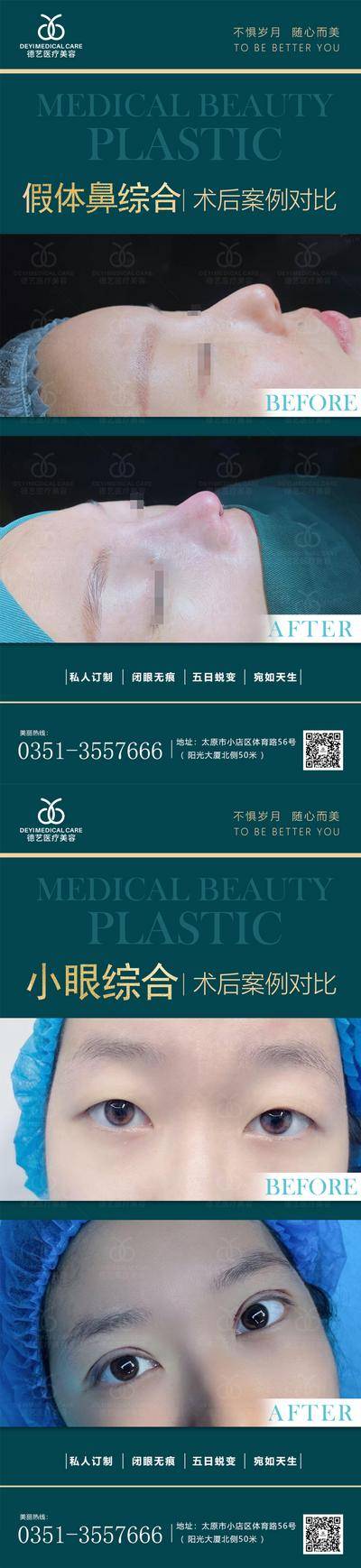 【南门网dcpsd.com】海报 医美 整形 眼综合 鼻综合 案例 对比