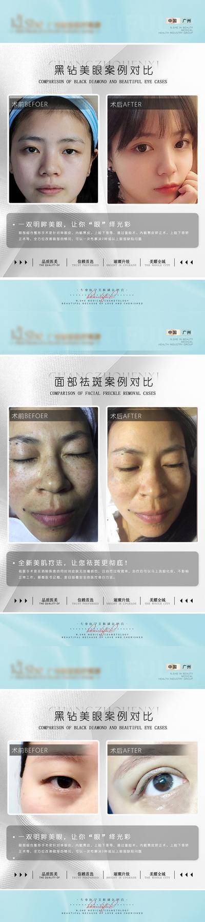 【南门网dcpsd.com】海报 医美 美容 案例 整形 对比图