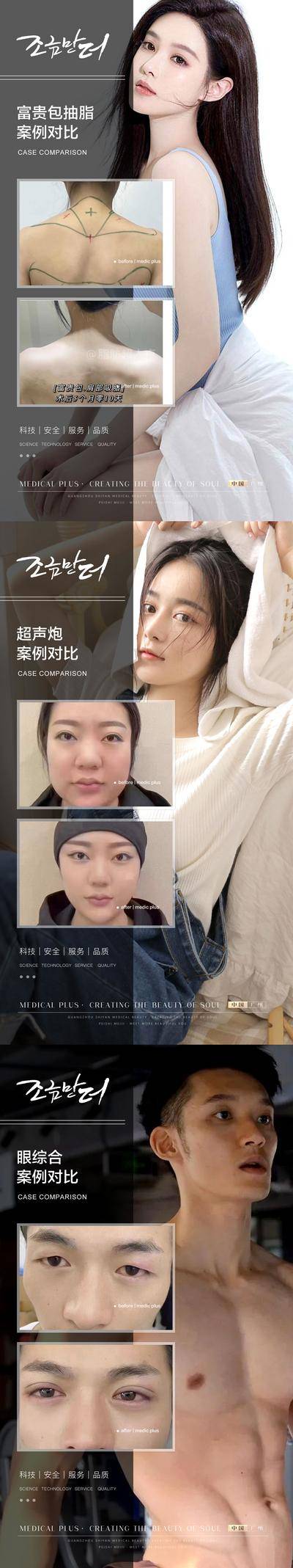 【南门网dcpsd.com】海报 医美 整形 美业 美容 案例 对比 简约 人物 系列 富贵包 抽脂 眼综合 超声炮