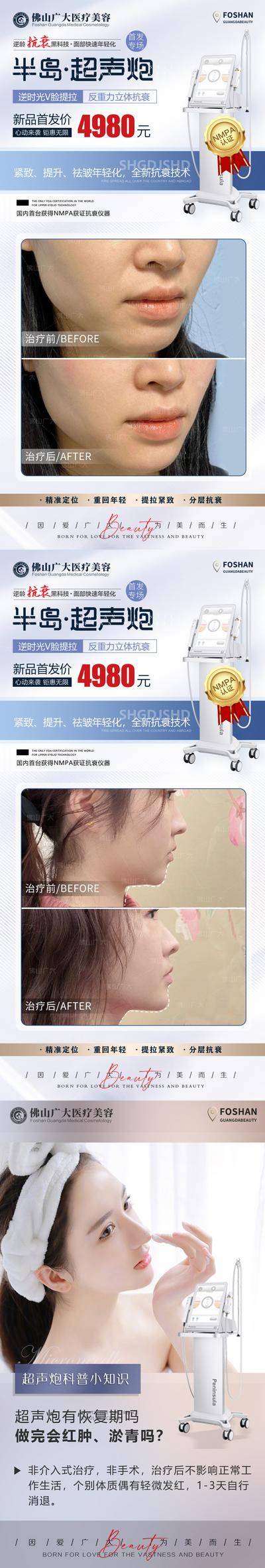 【南门网dcpsd.com】海报 医美 整形 超声炮 案例 对比 仪器 皮肤 科谱
