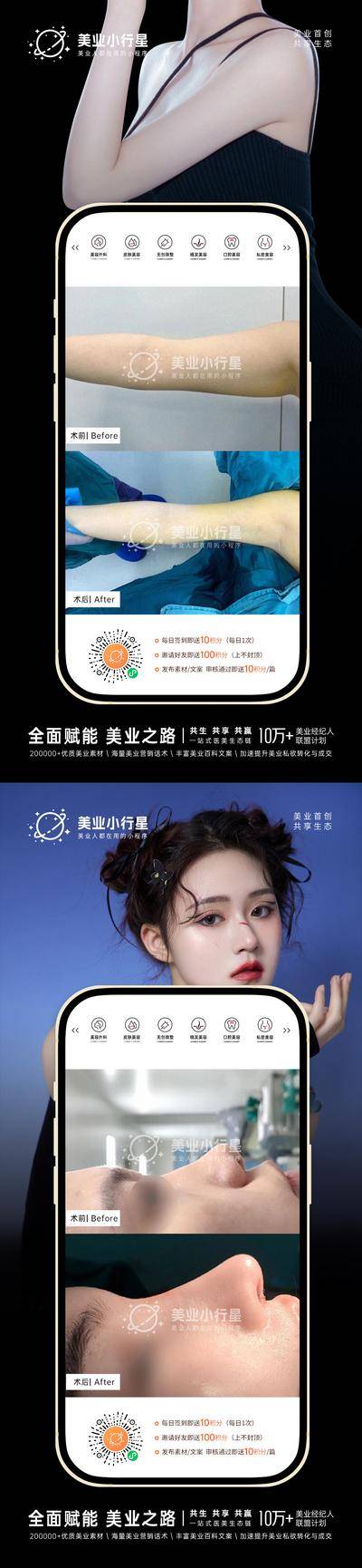 【南门网dcpsd.com】海报 医美 整形 真人案例 分享集 酒窝 吸脂 对比图