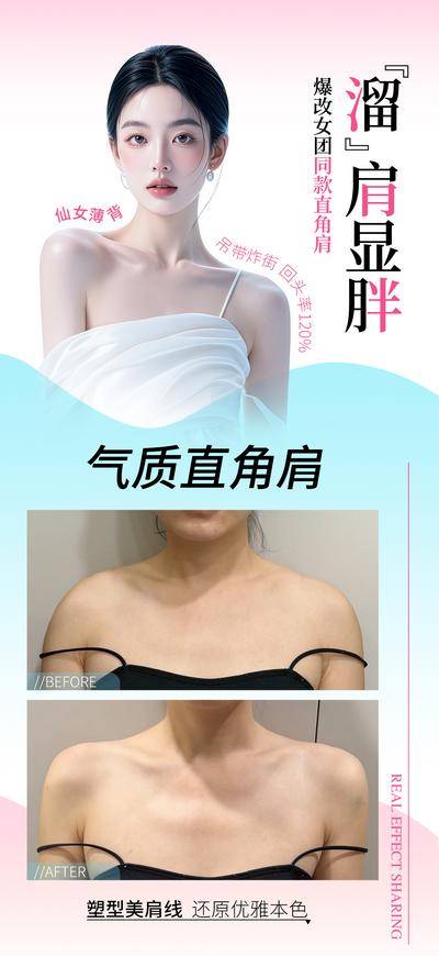 【南门网dcpsd.com】海报 医美 直角肩 案例对比 瘦肩针 模特